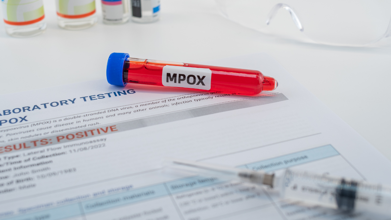 No case of mpox in Fiji The Fiji Times